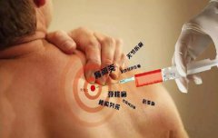 颈肩腰腿痛总反复 试试纯中药穴位注射疗法